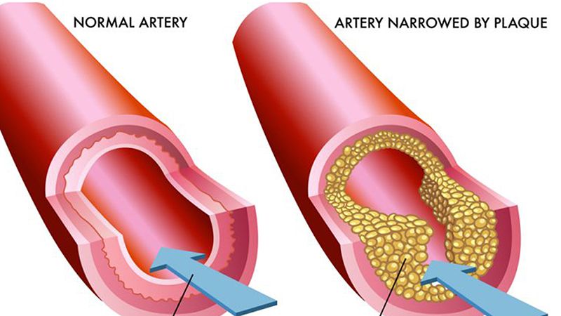 Health Info > Heart & Stroke - Men's Health Week